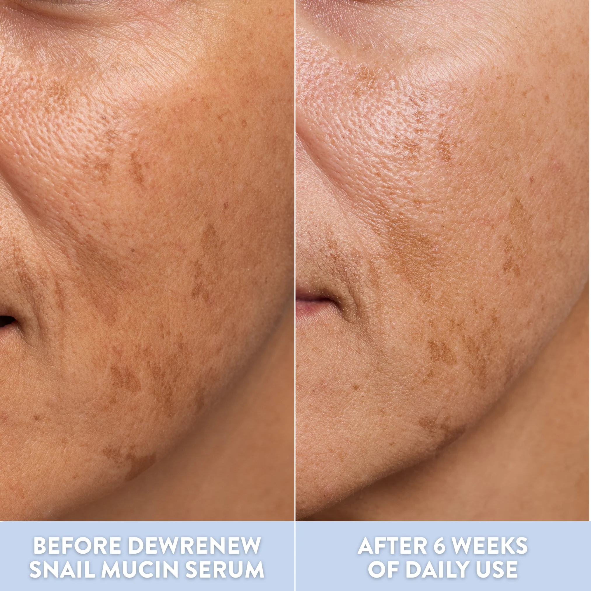 DewRenew Snail Mucin Serum - Image 10