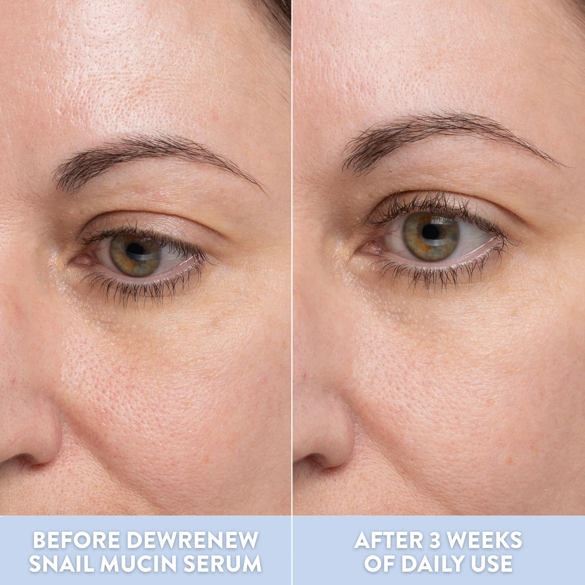 DewRenew Snail Mucin Serum - Image 8