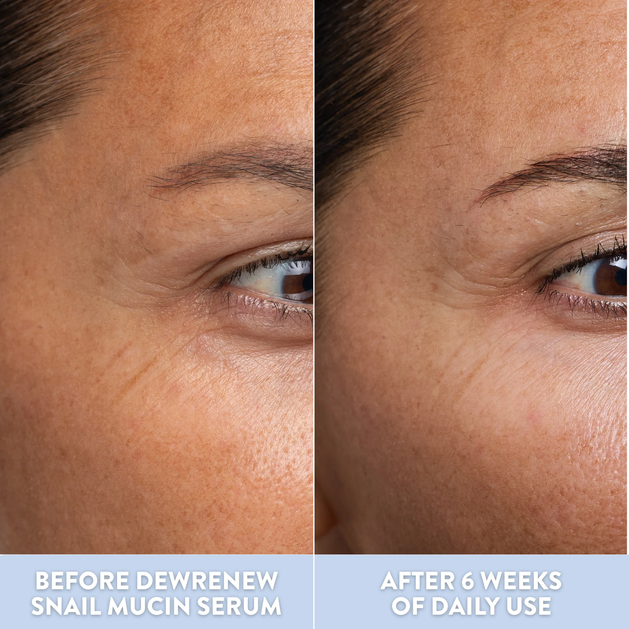 DewRenew Snail Mucin Serum - Image 9