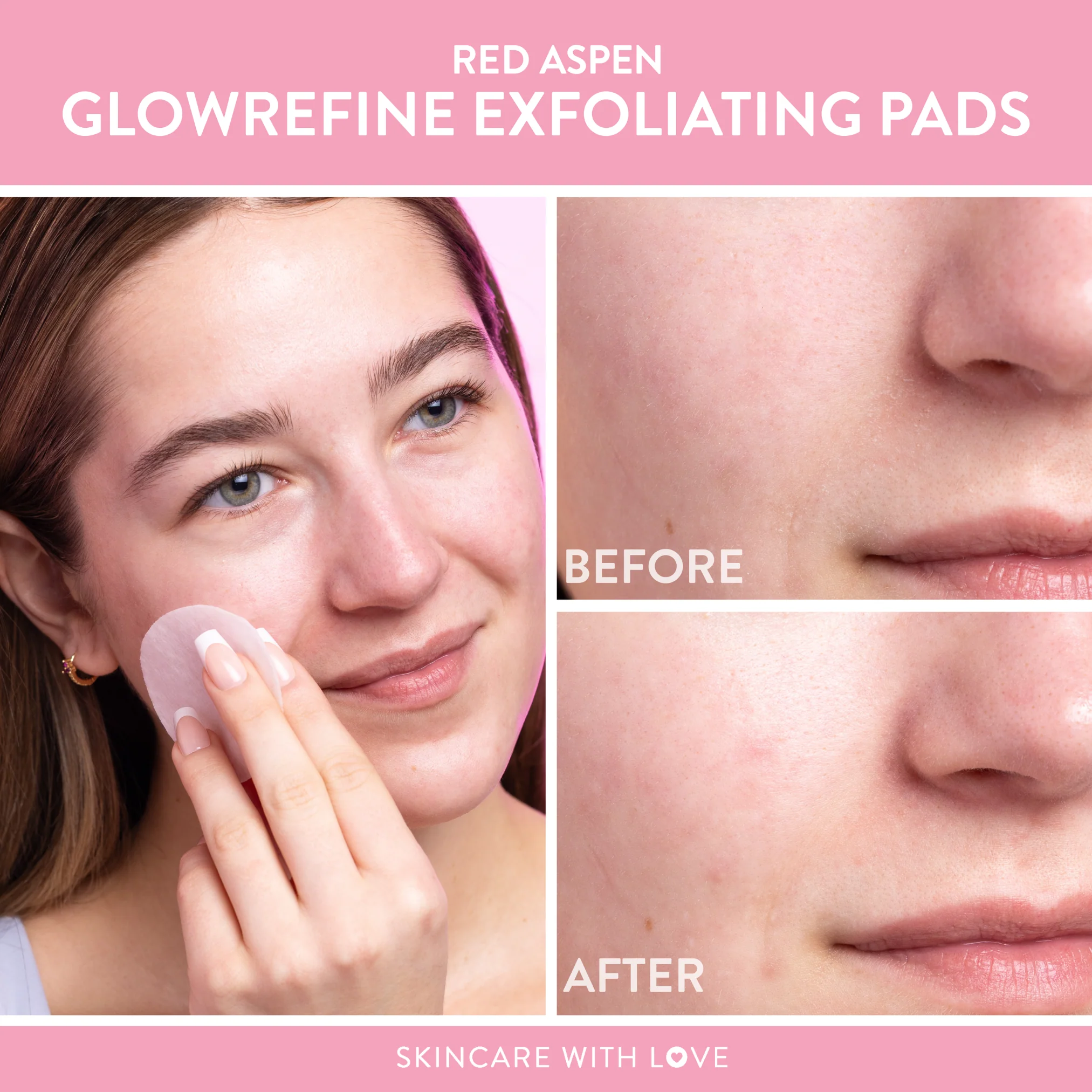 GlowRefine Exfoliating Pads - Image 7