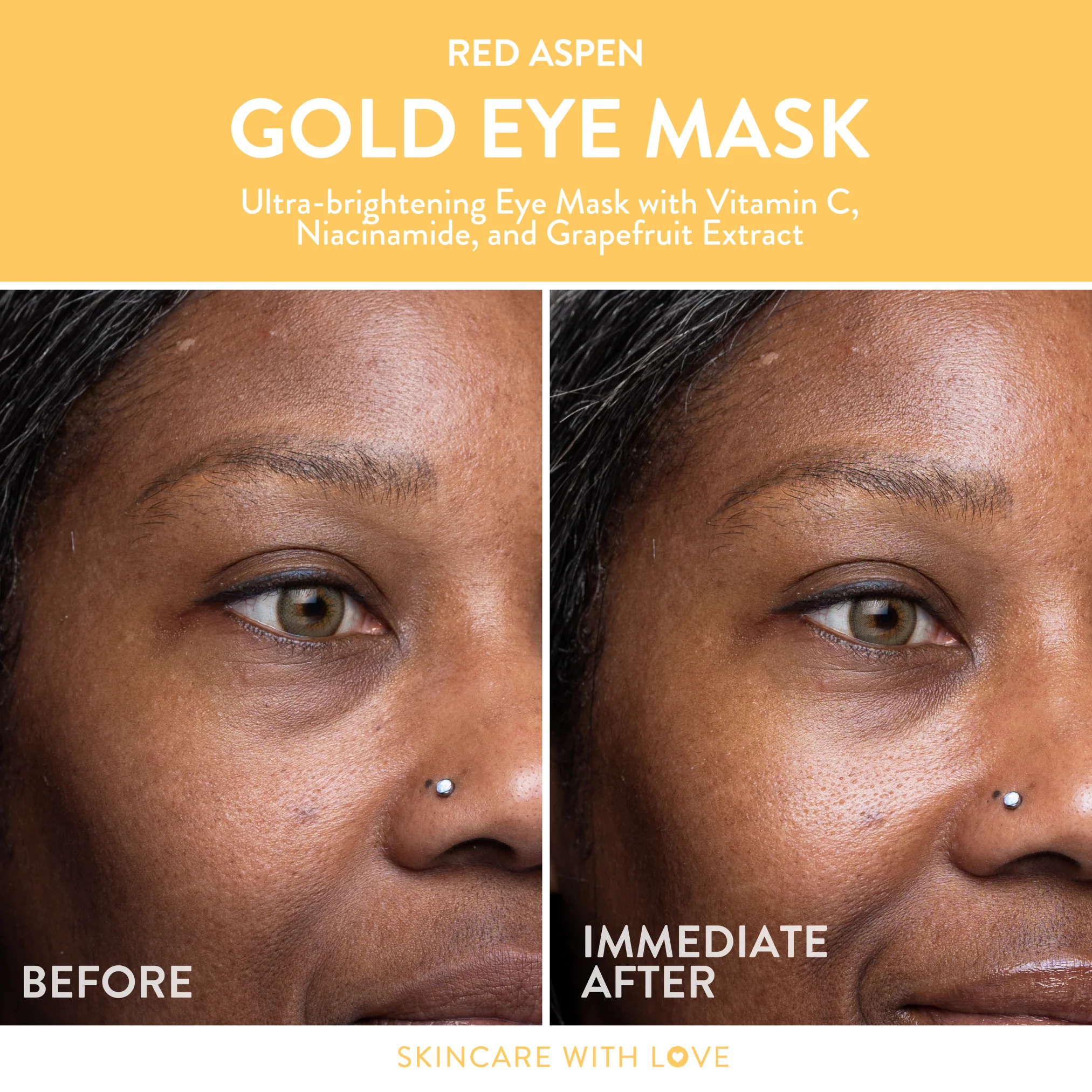 Gold Eye Mask - 5 Pack - Image 5