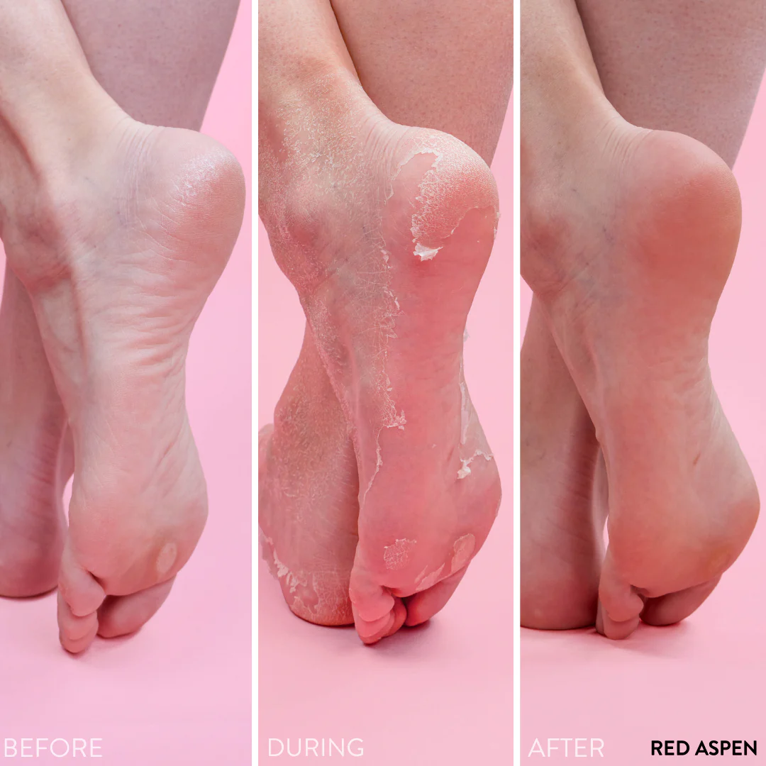 PediExfoliate Foot Peeling Mask - Image 4