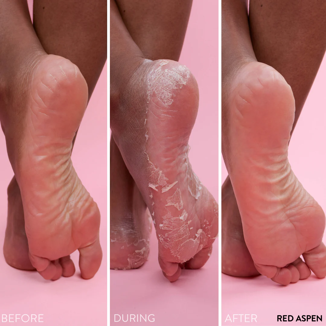 PediExfoliate Foot Peeling Mask - Image 5